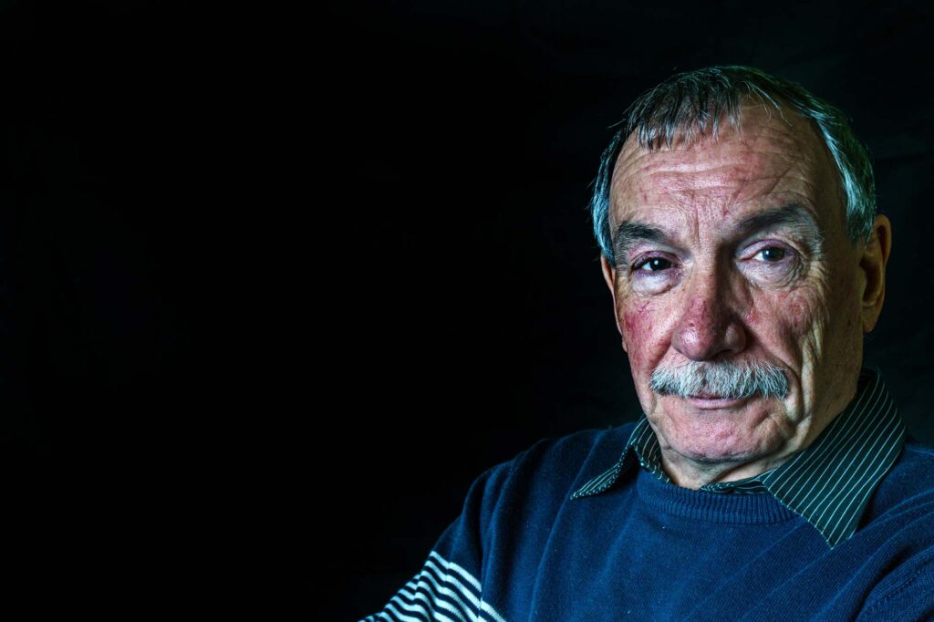 how to know if you have skin cancer