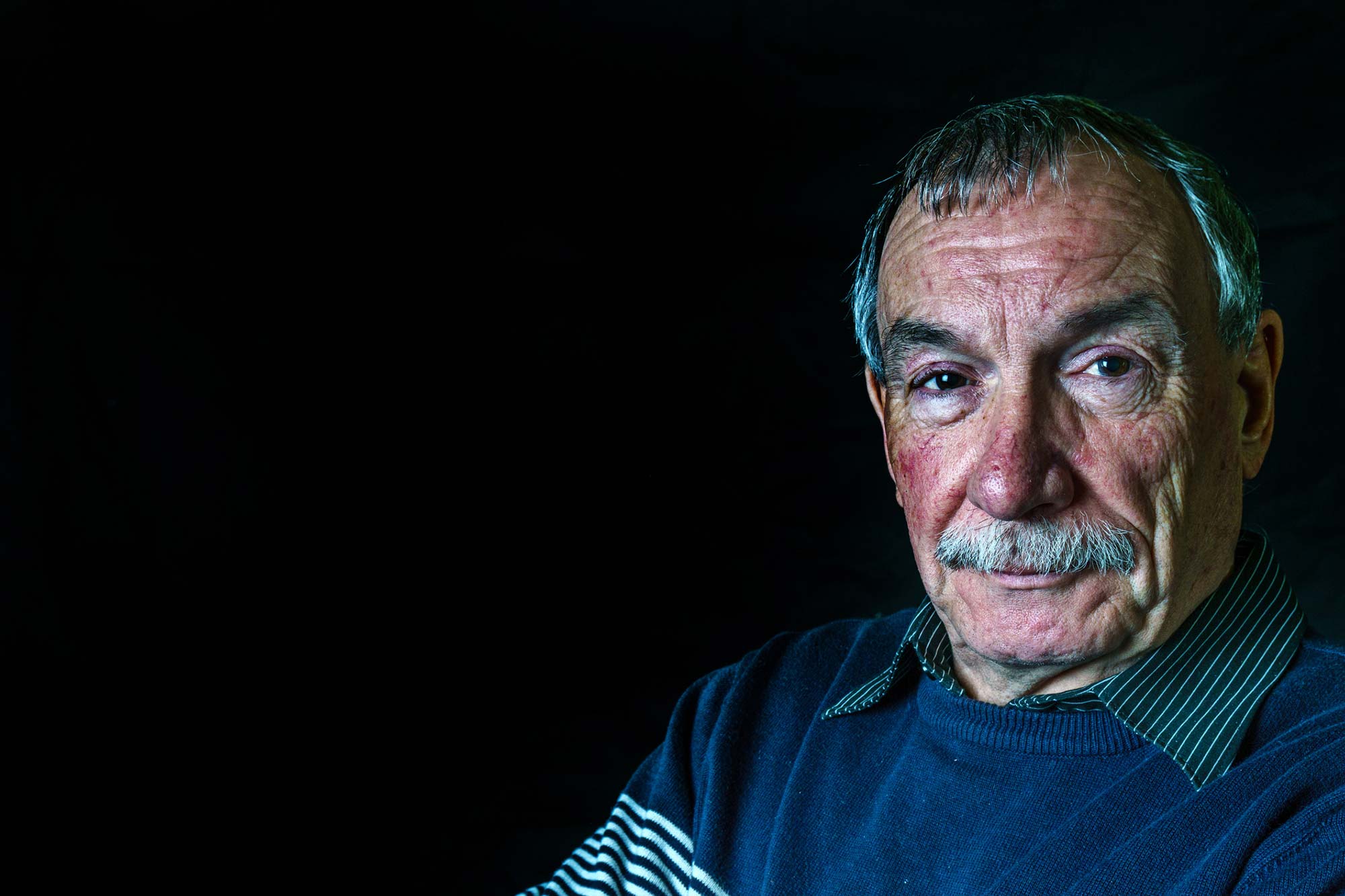 how to know if you have skin cancer