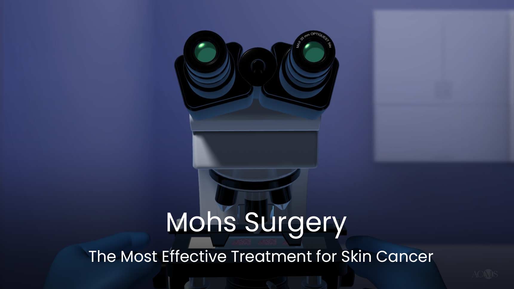 Mohs Surgery The Most Effective Treatment for Skin Cancer