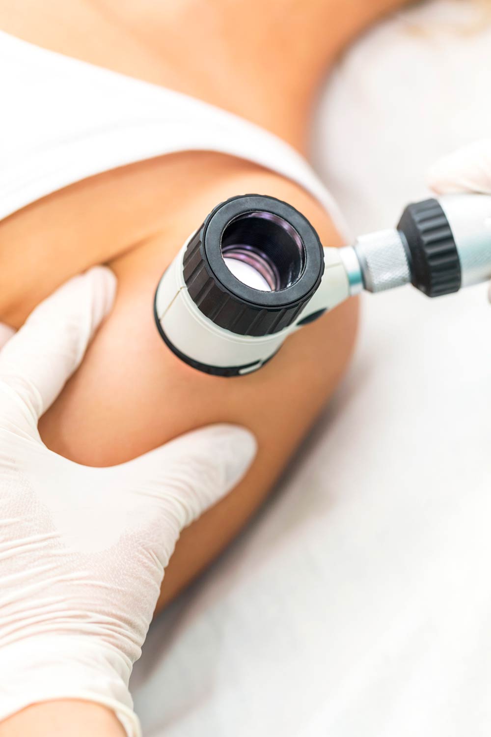 dermatology early detection of skin cancer
